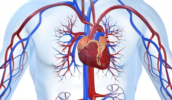 Οι  αγγειακές παθήσεις ευθύνονται για το 40% των θανάτων παγκοσμίως